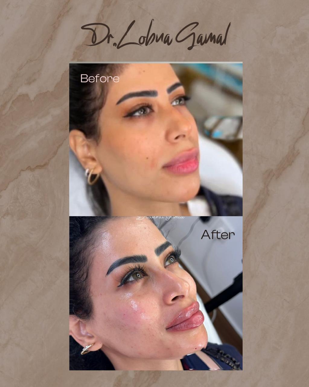 Treatment Result